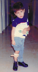 limb-photo6.gif (36170 bytes)